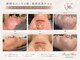 ビューティーブルーム(BeautyBloom)の写真