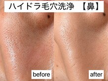マハロ(Mahalo.N)の雰囲気（圧倒的洗浄力に納得！！気になる毛穴汚れを一回で徹底洗浄☆）