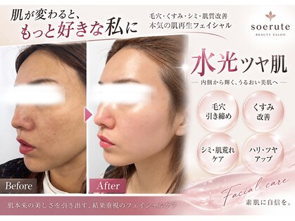 ソエルテ(soerute)の写真