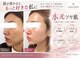 ソエルテ(soerute)の写真