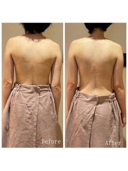 オクノマ(OKUNOMA)/【お客様BeforeAfter】