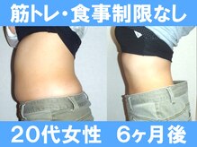 ユリシード 大阪分院(Ulyseeed)/６カ月で理想のお腹まわりへ♪ 