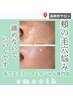 【肌質改善！エクソソームハーブピーリングコース】◎¥11,000