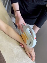 ロゼ(Rosse)/脱毛施術