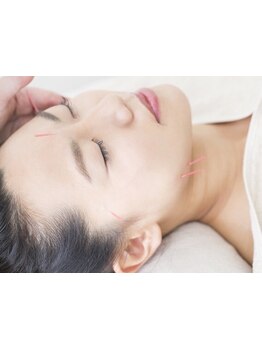 鍼灸施術を受けたい