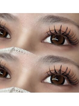 アリソン(Alison)/バインドロック