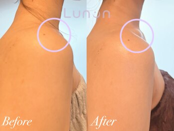 ルノン(Lunon)/【肩こり/巻き肩】肩甲骨はがし
