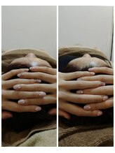 吉川美南ライフ整骨院/30代女性