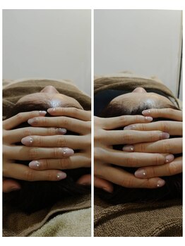 吉川美南ライフ整骨院/30代女性