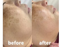 ラ フルール(La Fleur)/フェイスワックス