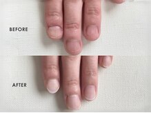 ネイルデコ(nail DECO)の雰囲気（5000件以上の実績！自爪育成は深爪/短い爪も美爪育成可能）