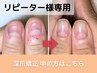 深爪矯正中の方はこちら【リピーター様専用】