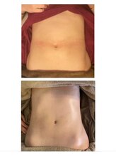 アイビー(ivy)/腸もみ