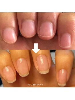 サロン ソルブ(salon solve)/３ヶ月でここまで変わる