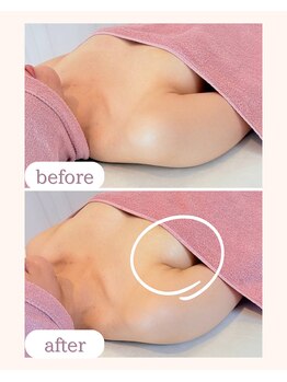 ワム(Wom)/タイプ別/横乳にボリューム変化