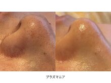 サロン アンネ(Anne)/プラズマニア