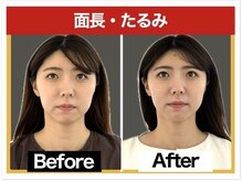 エレヴィザ トウキョウ 恵比寿院(ELVISA TOKYO)の雰囲気（口腔内小顔&リンパ小顔/恵比寿/渋谷/小顔/小顔矯正/骨盤/肩こり）