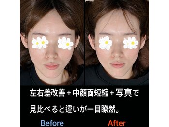 美容矯正サロン レレポノ(LELEPONO)/