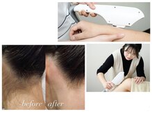 サンゴーハチ(358)の雰囲気（当店は都度払い♪丁寧に施術しています。脱毛資格保有◎）