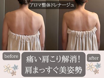 ミトラ(MITRA)/こり楽☆肩の高さまっすぐ美姿勢