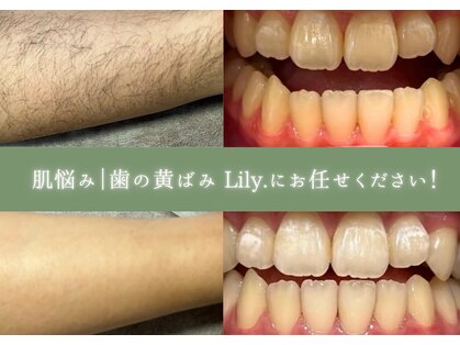 リリー(Lily.)の写真