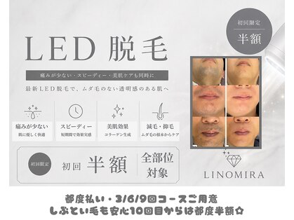 リノミラ(LINOMIRA)の写真