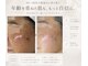 リベラサロン(LIBERA SALON)の写真/今から始める未来の肌への投資。シミや自分ではケアして諦めてた肌を整える！