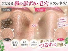 イアリイ/毛穴洗浄エステコース
