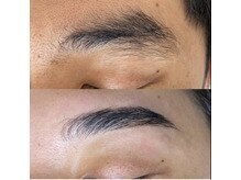 リルモナ(RIREMONA)/