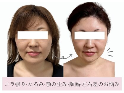 ポノ(Pono)の写真