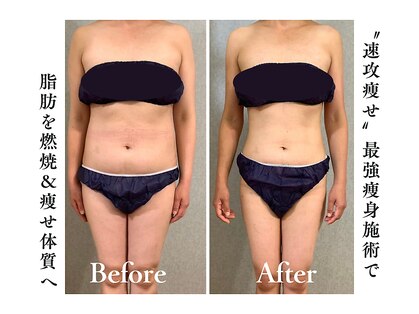 アイ エステサロン(Ai)の写真