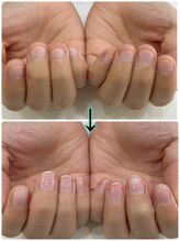 ネイルアロマ(Nail AROMA)/ネイルケア症例