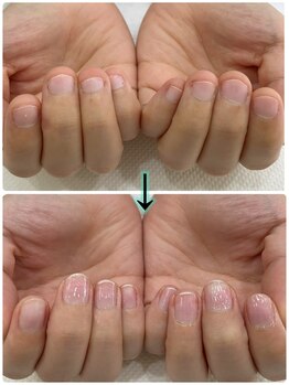 ネイルアロマ(Nail AROMA)/ネイルケア症例