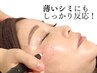 【シミケア定番☆】本格シミケア＊時間選択可能｜¥12,100⇒¥7,700