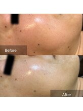 フルブルーム(Full Bloom)/ララピール 