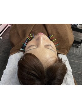 ホウレイ線・たるみ改善！予防ケア