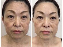 ニカ(NIKA)の雰囲気（光フェイシャルで若さを取り戻そう！）