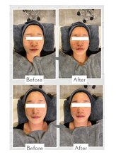 リノ ショウナン(LINO SHONAN)/ポテンツァモニター様