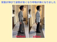 はしもと鍼灸整骨院/整体before→after