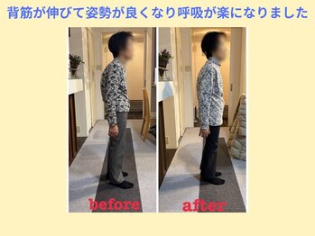 はしもと鍼灸整骨院/整体before→after