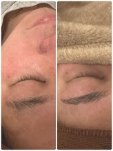 レーヴ(Reve)/【ブロウリフト】美眉毛作ります