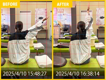整体院 元 くまなん店/右肩や首の悩み