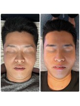 ステラ 武蔵小杉(Stella)/プラズマ B/A