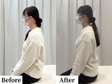 ソレア(Solea)/肩甲骨・巻き肩・猫背改善1回目