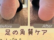 ニービー ネイルズ(2B NAILS)