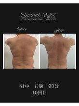 ベルフィーヌボーテ(BELFINE beaute)/シークレットM痩身