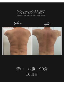 ベルフィーヌボーテ(BELFINE beaute)/シークレットM痩身