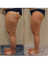 カルナボディ(Carna body.)/下半身痩せ＆冷え・むくみ解消