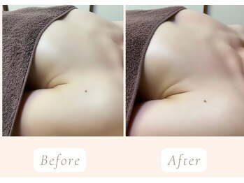 ノルン(Norn)/30代育乳バストケア（5回目）