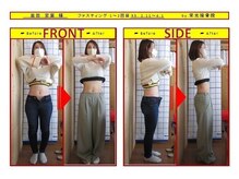 栄光治院 豊田院/痩身ビフォーアフターブログ掲載